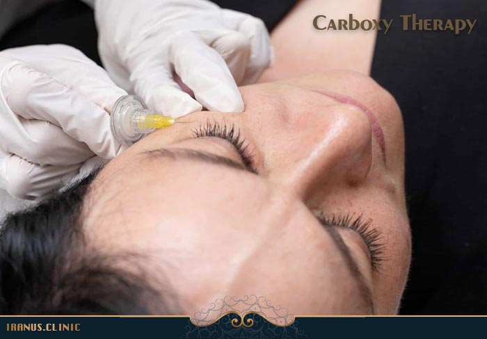 کربوکسی تراپی زیر چشم
