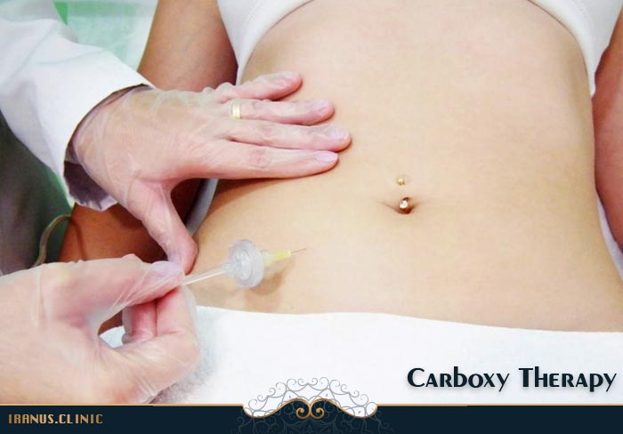 کربوکسی تراپی شکم