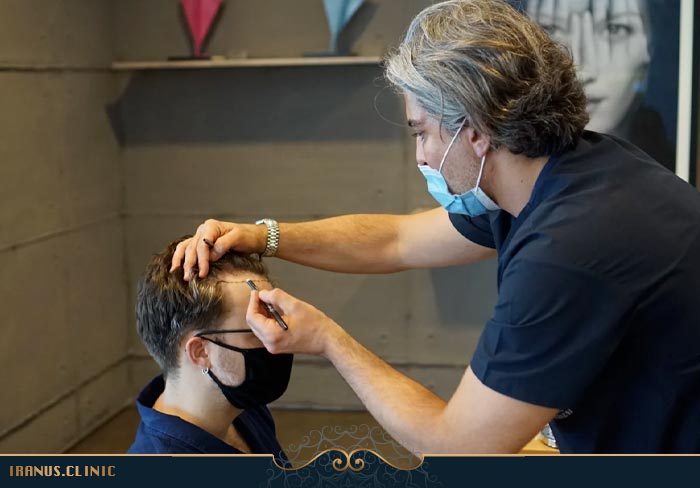 طراحی خط رویش مو