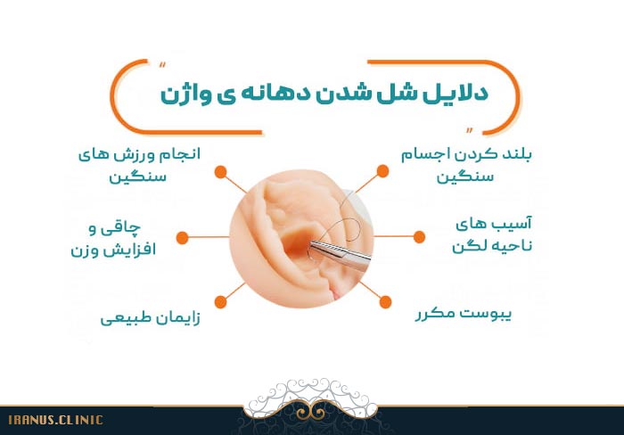 دلایل شل شدن دهانه واژن