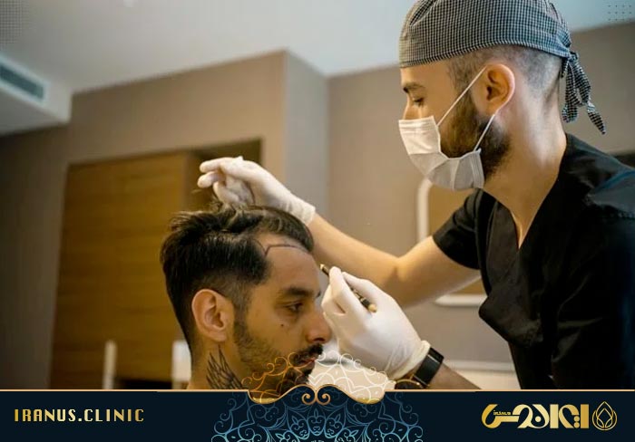 طراحی خط رویش کاشت مو