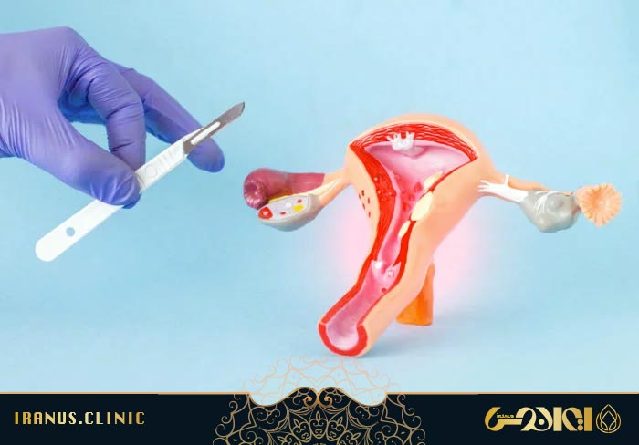 جراحی تنگ کردن واژن