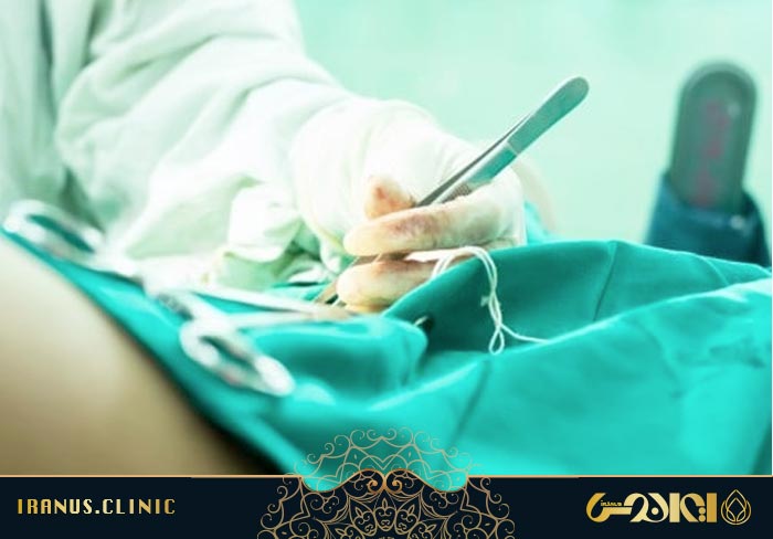 عوارض واژینوپلاستی