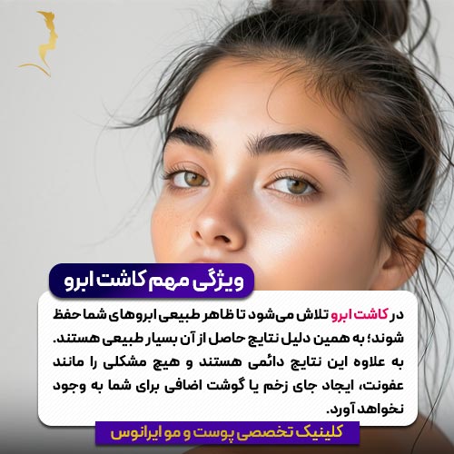 ویژگی مهم کاشت ابرو