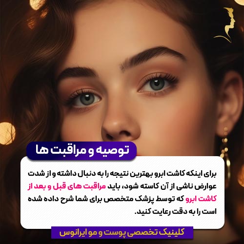 مراقبت های کاشت ابرو