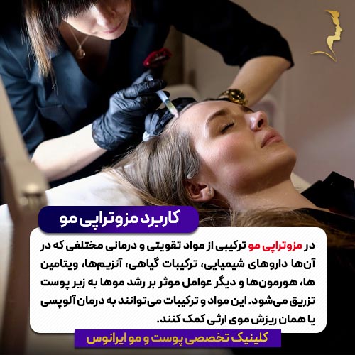 کاربرد مزوتراپی مو