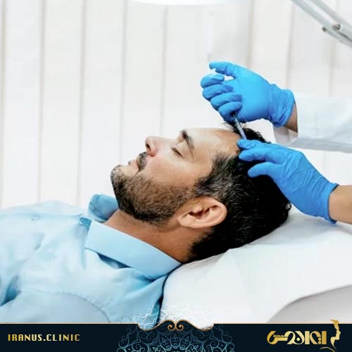 مزوتراپی موی سر مردان