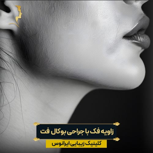 زاویه فک با جراحی بوکال فت