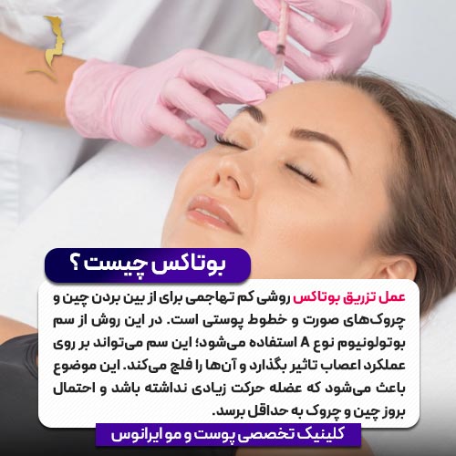 تزریق بوتاکس