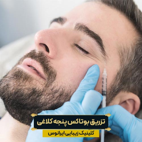 تزریق بوتاکس خطوط دور چشم