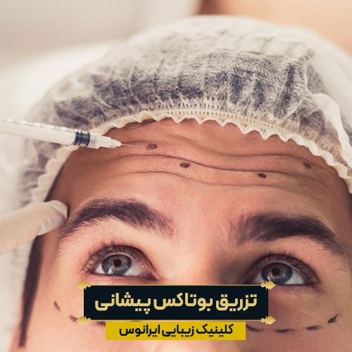تزریق بوتاکس پیشانی