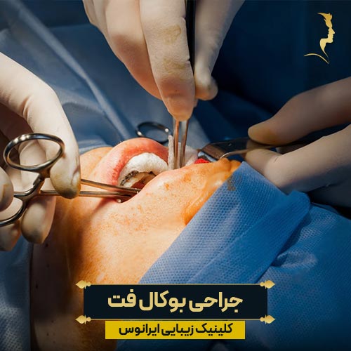جراحی بوکال فت