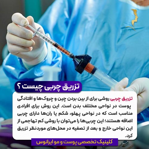 ترزیق چربی چیست