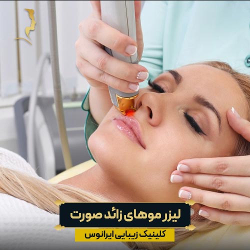 لیزر موهای زائد صورت