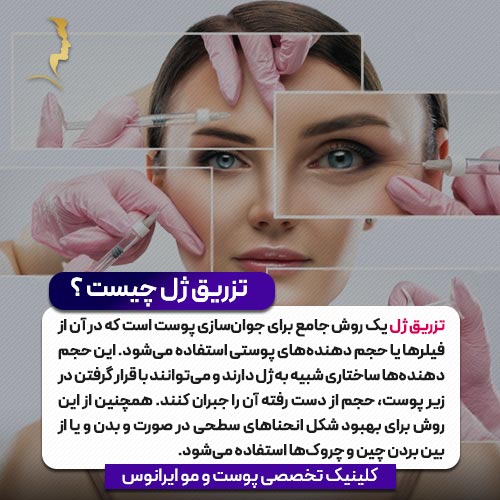 تزریق ژل چیست
