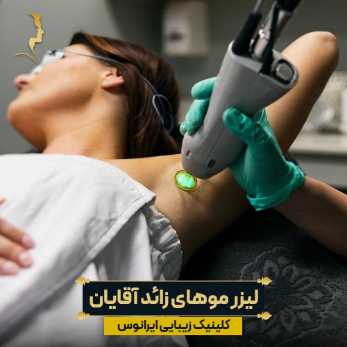 لیزر موهای زائد زیر بغل