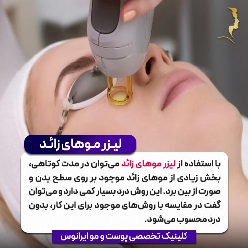 لیزر موهای زائد