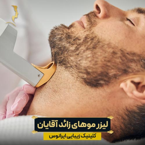 لیزر موهای زائد آقایان