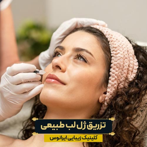 تزریق ژل لب طبیعی