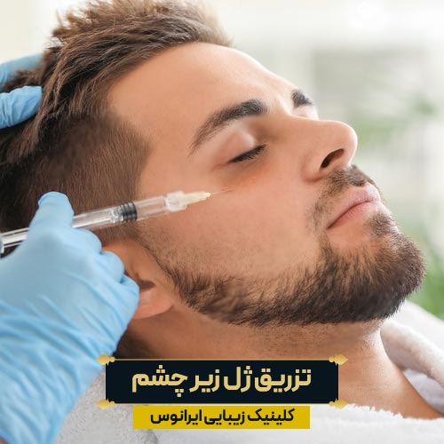 تزریق فیلر زیر چشم