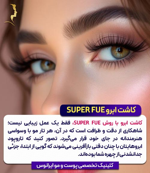 کاشت ابرو به روش Super fue
