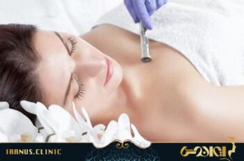 میکرودرم ابریژن
