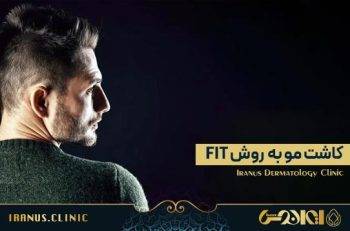 کاشت مو به روش FIT