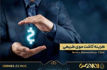 هزینه کاشت مو