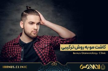 کاشت مو به روش ترکیبی