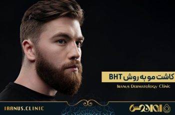کاشت مو به روش BHT