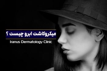 کاشت ابرو به روش میکروکاشت